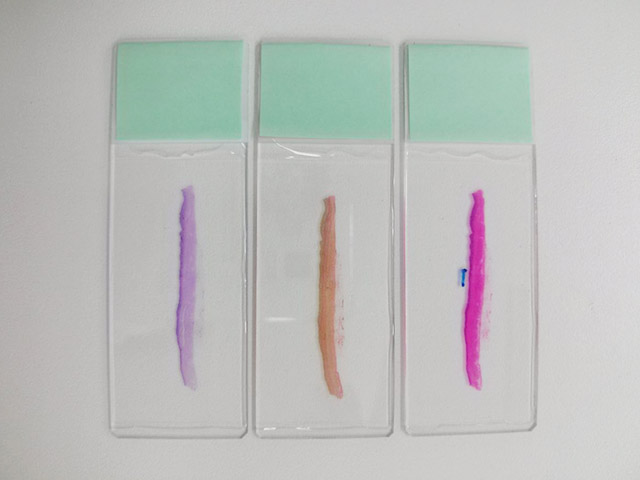 完成した標本（左からAlcian blue-PAS染色、EVG染色、HE染色）